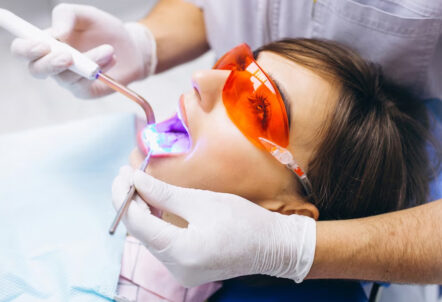 Can Cavities Be Treated With Laser Dentistry? Navigating the Possibilities