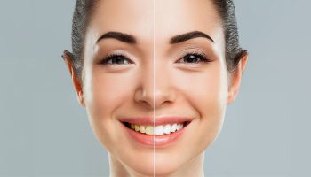 Why Smile Design Is the Go-To Cosmetic Treatment in Breckenridge, CO?