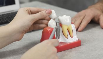 Single Tooth or Full Smile? Dental Implant Options Available in Breckenridge, CO